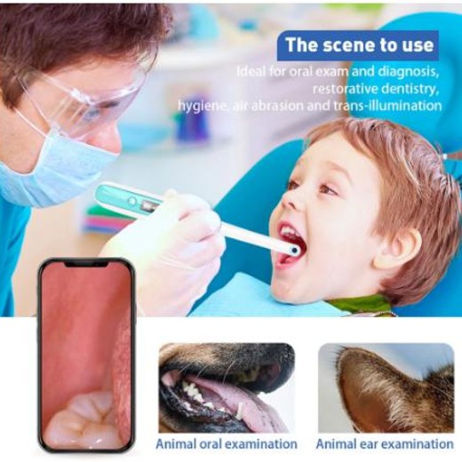 Csfhtech Wireless WiFi Oral Dental Endoscope HD Oral Intraoral Endoscope Camera LED Light Real-time Video Inspection Teeth Whitening Tool